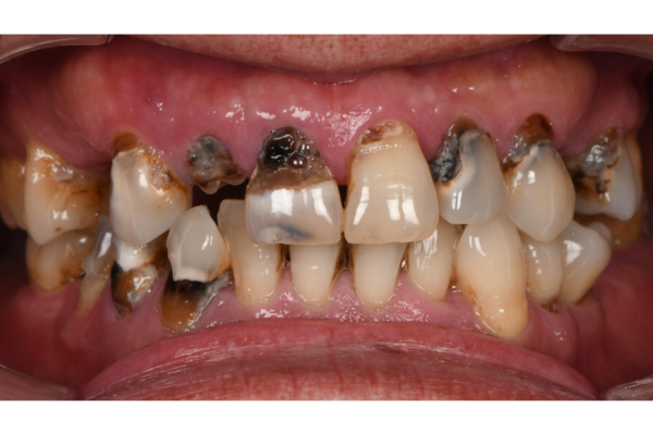 Trước điều trị